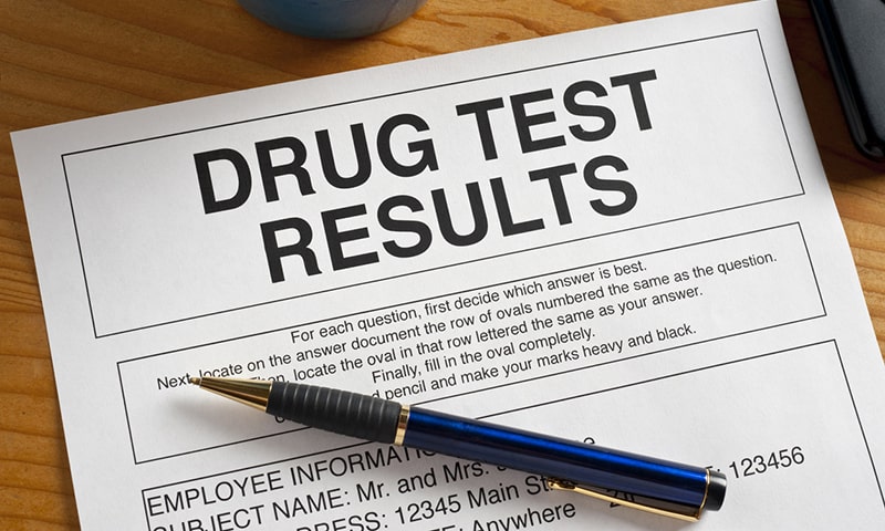 does cbd show up in drug tests